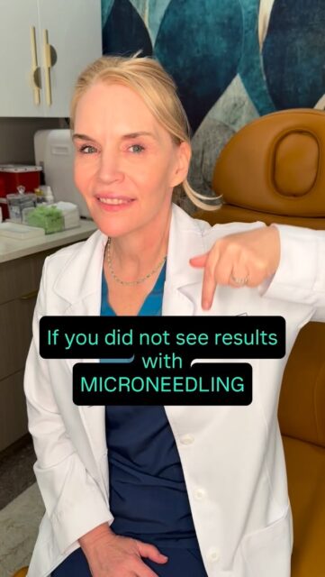 Microneedling isn&rsquo;t a one-and-done treatment.

If you didn&rsquo;t see dramatic results after your first session, don&rsquo;t give up. ✨

Microneedling works by stimulating your body&rsquo;s natural collagen production, and collagen remodeling takes time. Most patients start noticing meaningful improvements after a series of treatments, with continued improvements for months afterward.

Think of it like going to the gym&mdash;you wouldn&rsquo;t expect one workout to transform your body. Consistency is where the magic happens.

✔️ Improved skin texture
✔️ Softer fine lines
✔️ Reduced acne scars
✔️ Firmer, healthier-looking skin

Trust the process. Your future skin is worth it.

Ready to build your treatment plan? Send me a message or book your consultation today.

#Microneedling #smoothskin #friscomoms #FriscoBeautyNurse