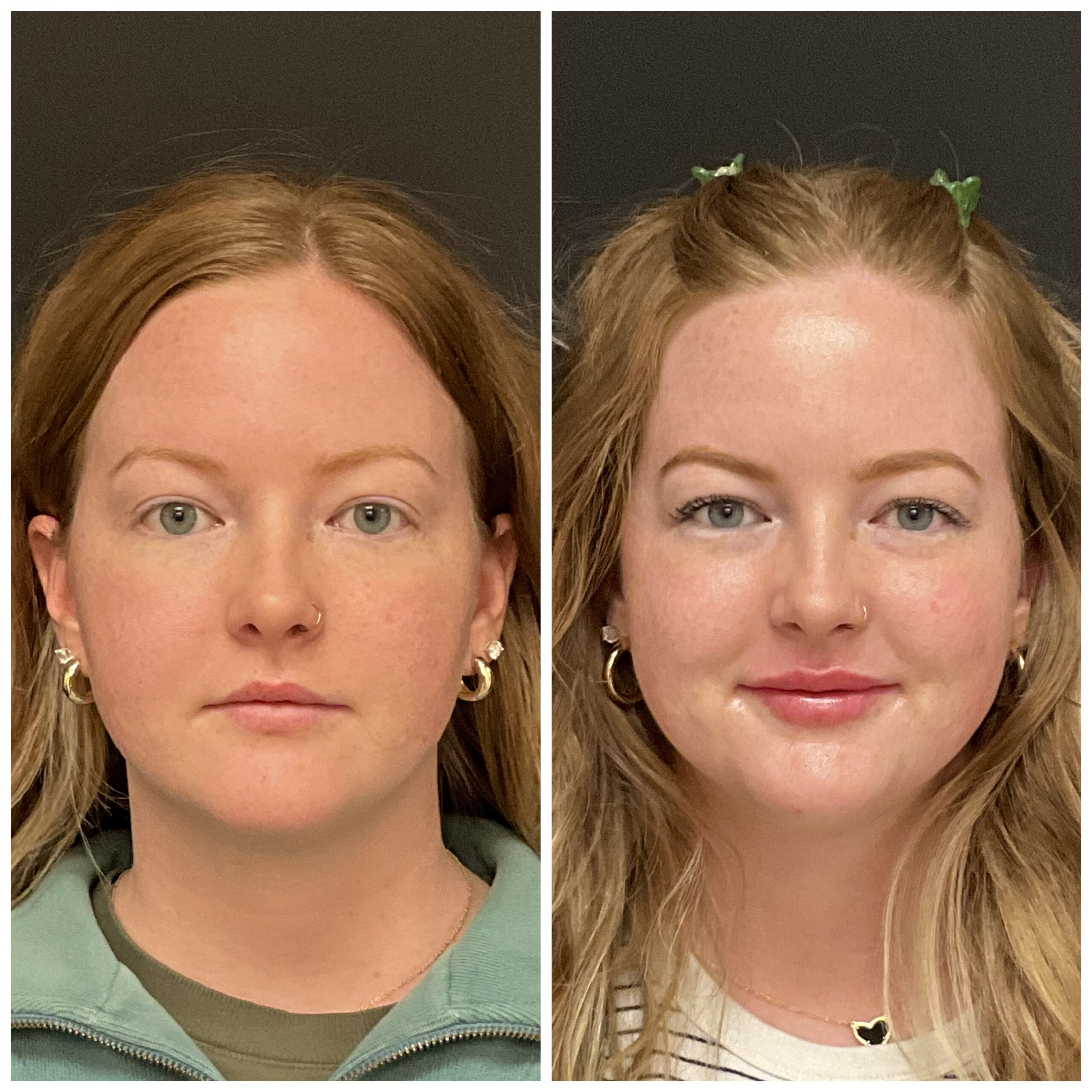 DiamondGlow results for lips and skin texture