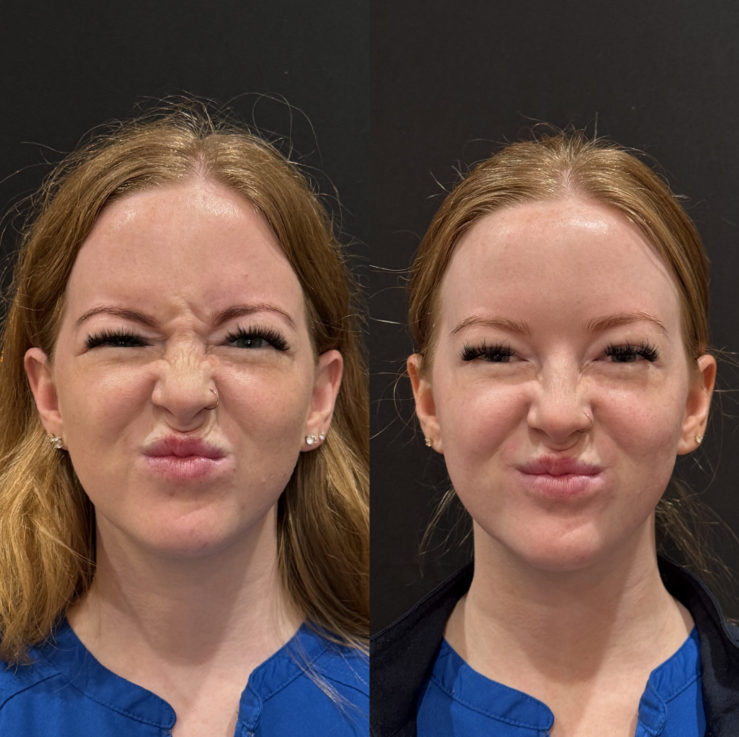 Frisco Beauty Nurse provider expertise