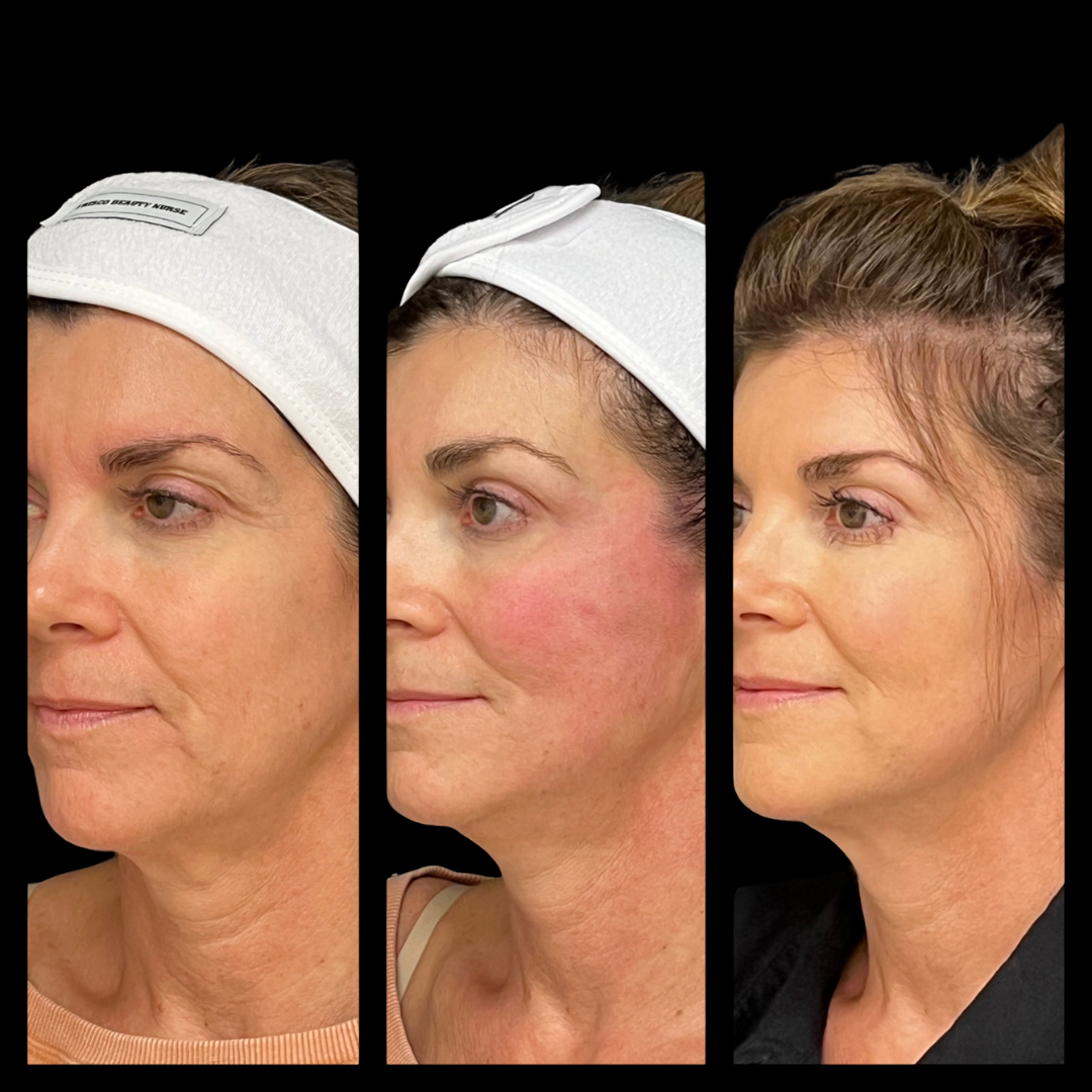 Sun damage and skin aging concerns