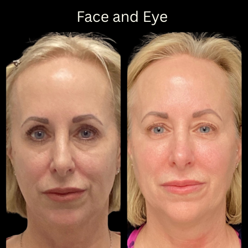 Photo Sep 01 2025, 10 17 18 PM (13)