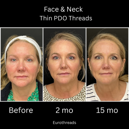 Photo Sep 01 2025, 10 17 18 PM (20)