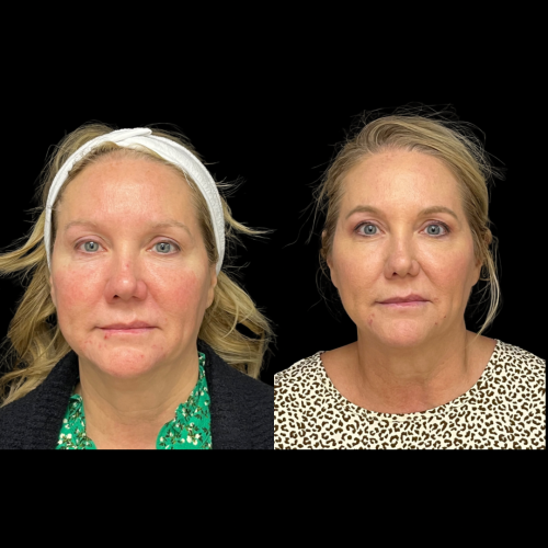 Photo Sep 01 2025, 10 17 18 PM (22)