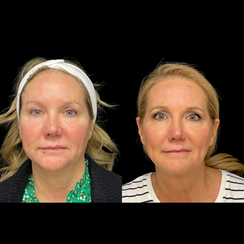 Photo Sep 01 2025, 10 17 18 PM (23)