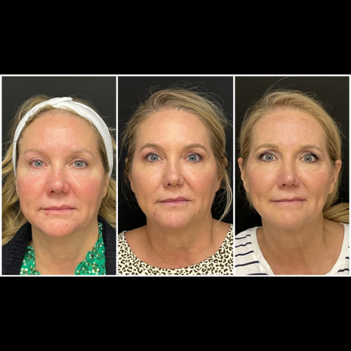 Photo Sep 01 2025, 10 17 18 PM (8)