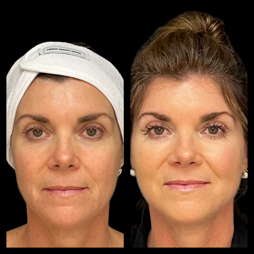 Photo Sep 01 2025, 10 49 46 PM (2)