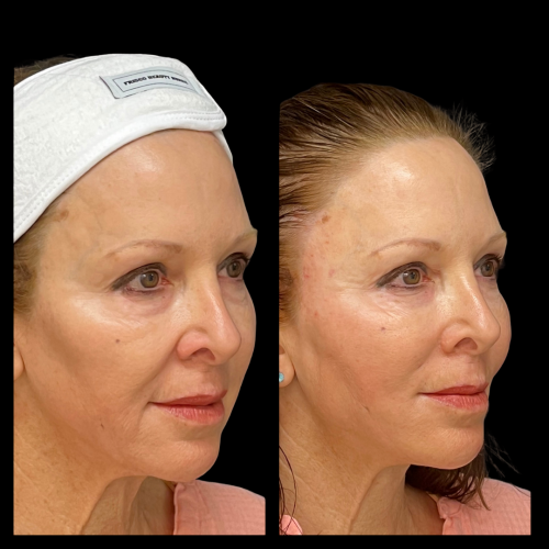 Photo Sep 01 2025, 10 49 46 PM (5)