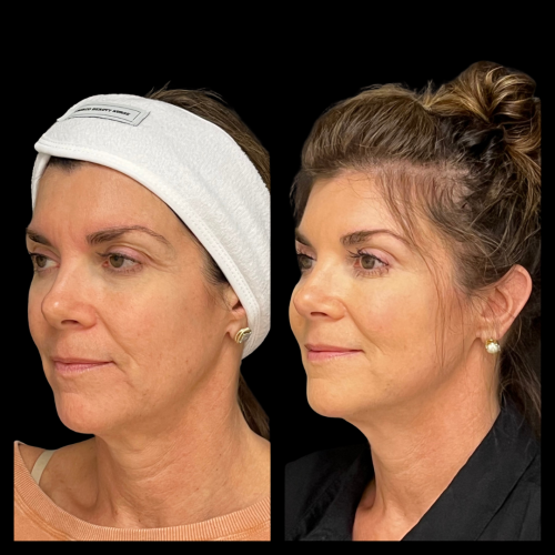 Photo Sep 01 2025, 10 49 46 PM