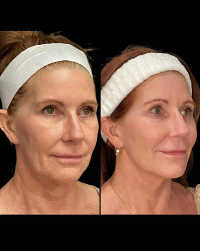 Photo Sep 02 2025, 7 12 01 AM (1)