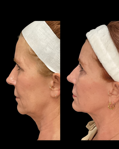 Photo Sep 02 2025, 7 12 01 AM (2)