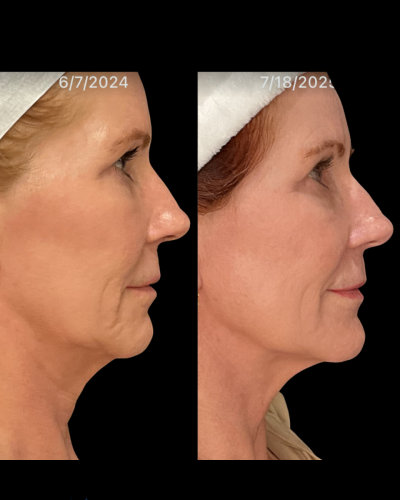 Photo Sep 02 2025, 7 12 01 AM (3)